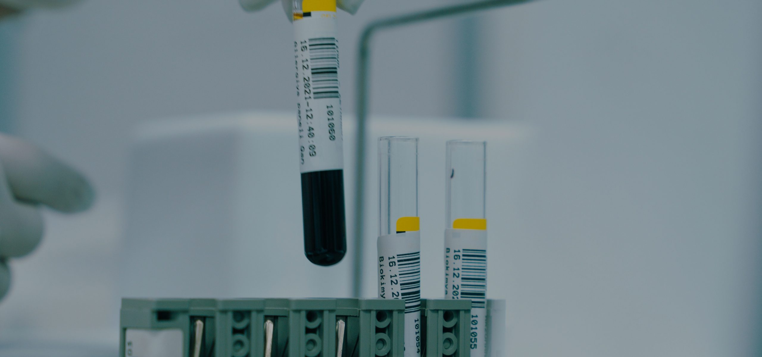 Análises Clínicas Aplicadas ao Estilo de Vida e Oncologia Análises Clínicas Aplicadas ao Estilo de Vida e Oncologia